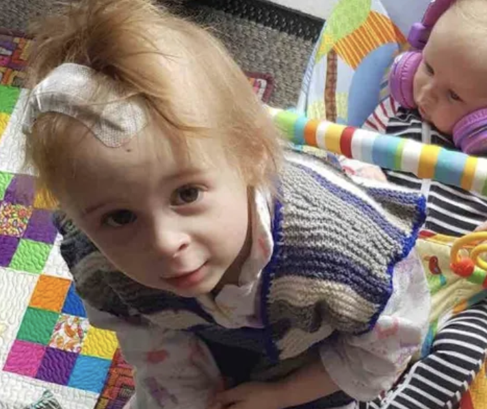 Young girl with cancer with dressing on her head